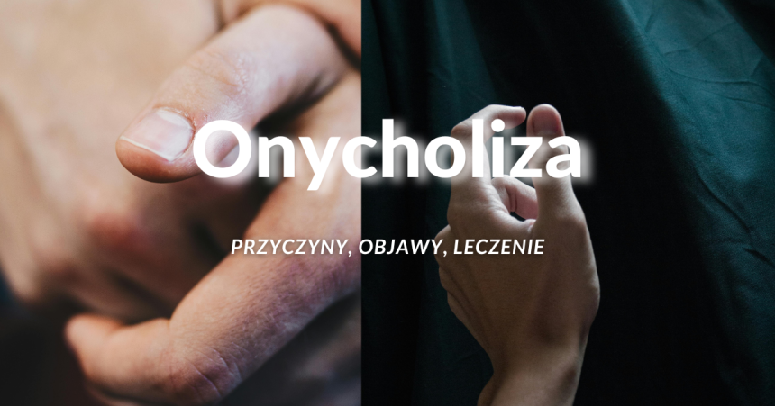 Co to jest onycholiza?