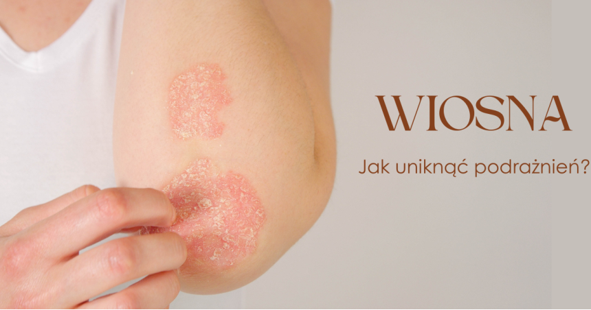 Alergie skórne i egzema na wiosnę – jak unikać podrażnień?