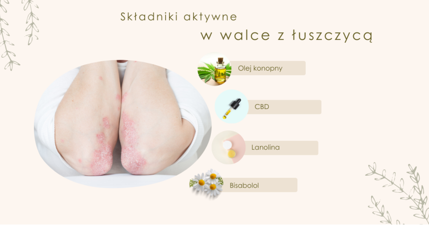 Składniki aktywne w walce z łuszczycą – co naprawdę działa?