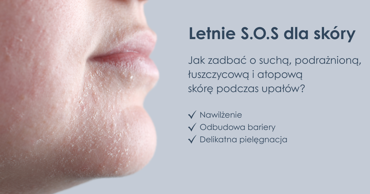Letnie SOS dla skóry – jak zadbać o suchą, podrażnioną, łuszczycową i atopową skórę w czasie upałów?