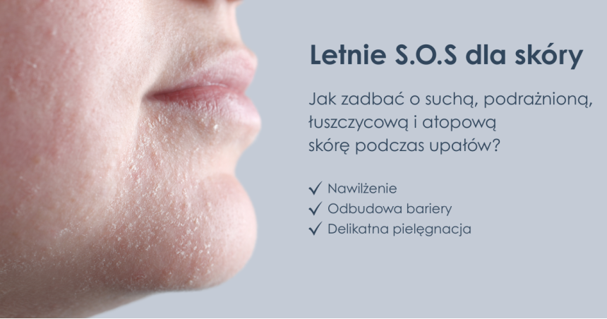 Letnie SOS dla skóry – jak zadbać o suchą, podrażnioną, łuszczycową i atopową skórę w czasie upałów?