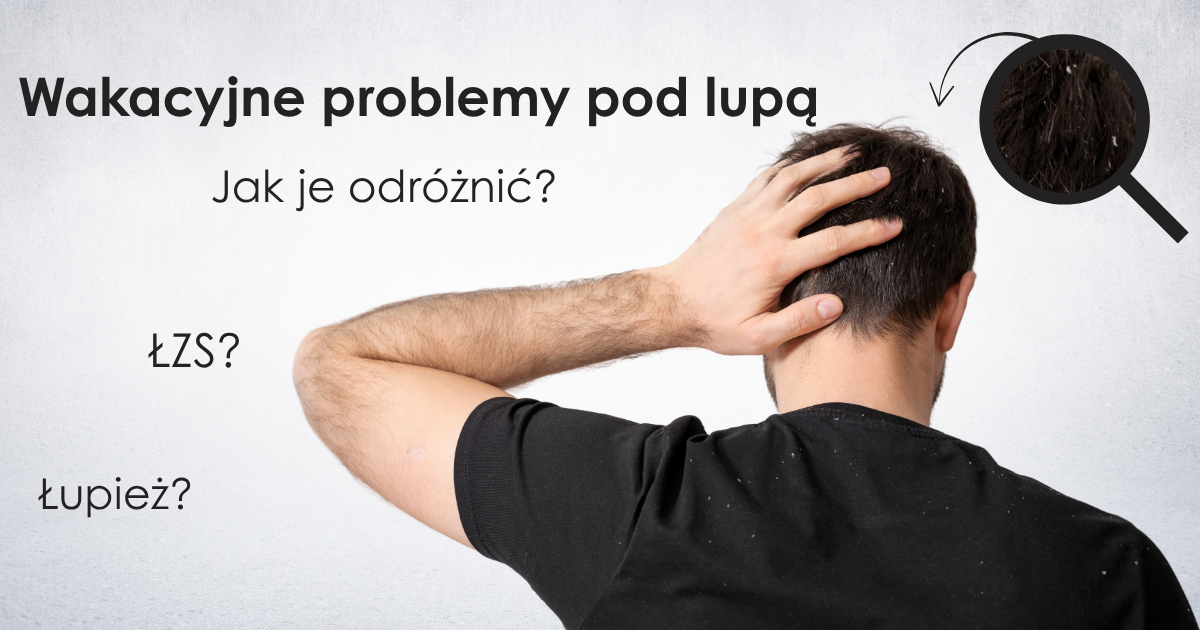 Jak odróżnić łupież od ŁZS? Wakacyjne problemy skóry głowy pod lupą