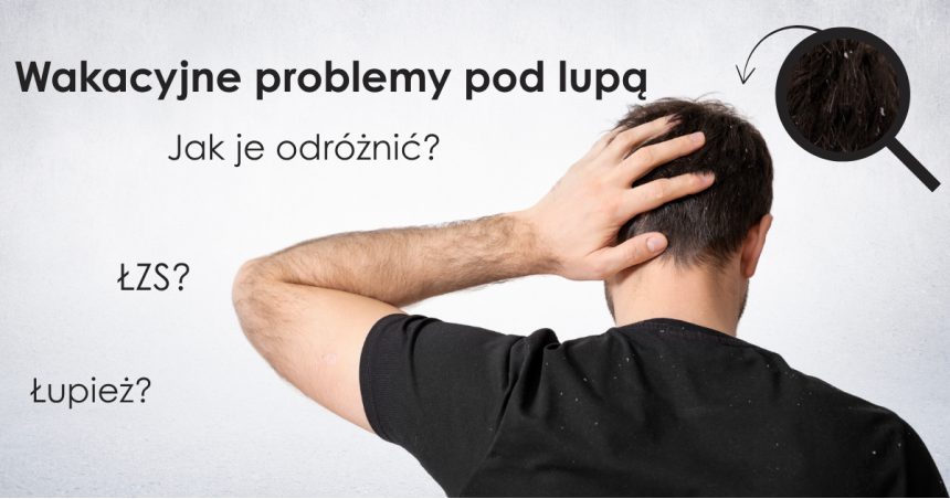 Jak odróżnić łupież od ŁZS? Wakacyjne problemy skóry głowy pod lupą