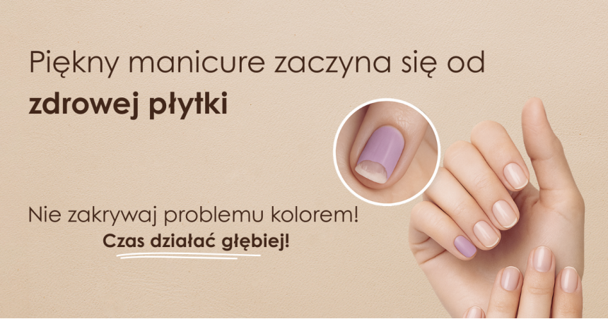 Onycholiza – czy Twoje paznokcie psują wakacyjny manicure