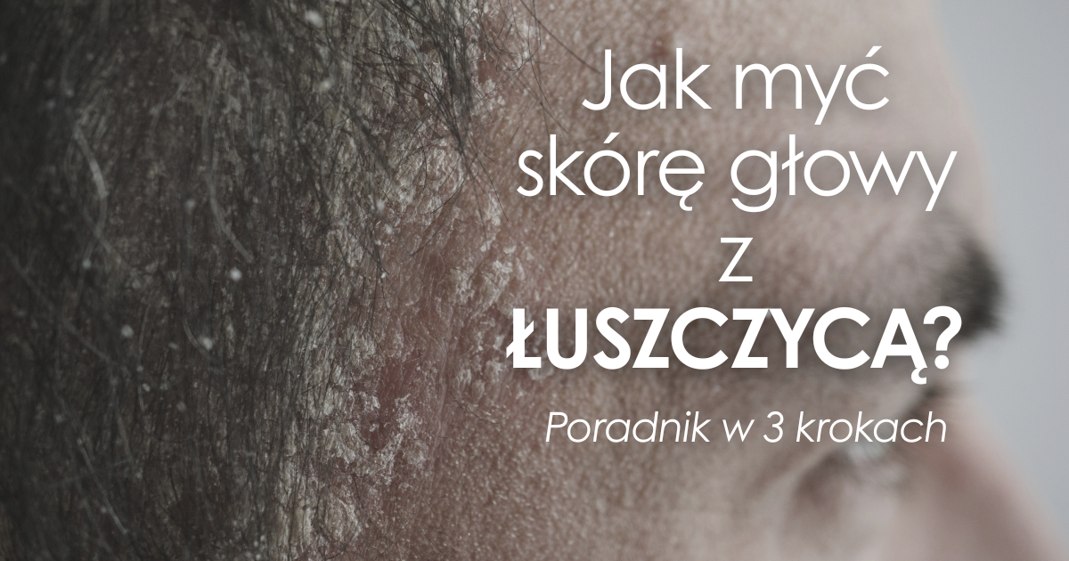 Jak często i prawidłowo myć skórę głowy z łuszczycą?