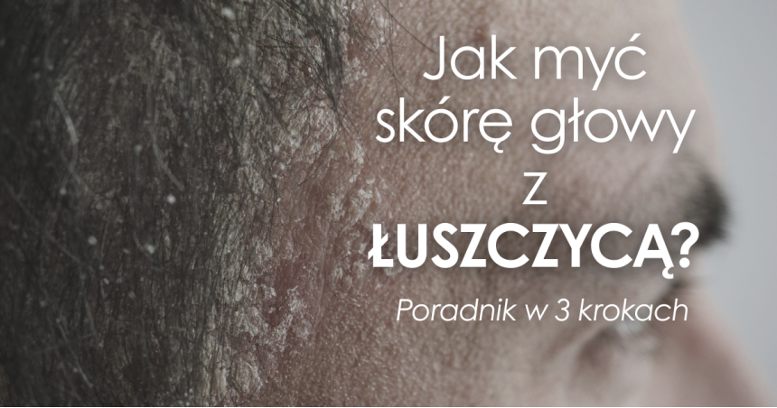 Jak często i prawidłowo myć skórę głowy z łuszczycą?