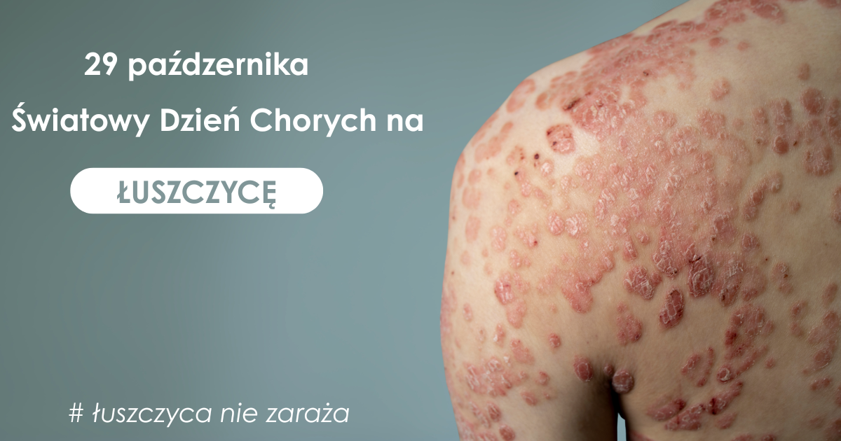 29 października - Światowy Dzień Chorego na Łuszczyce