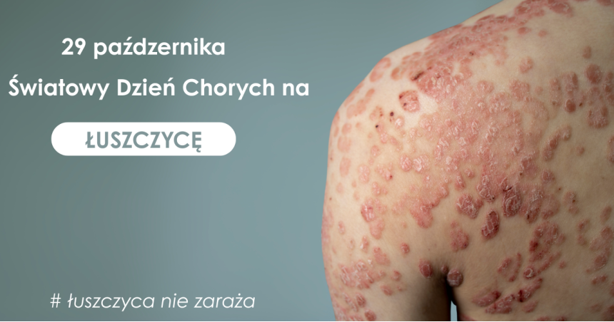 29 października - Światowy Dzień Chorego na Łuszczyce
