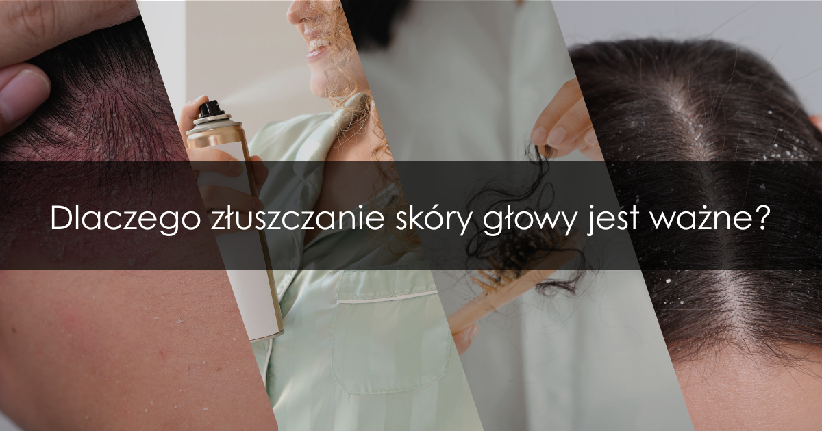 Peeling skóry głowy – dlaczego warto go stosować? Działanie, efekty i zastosowanie