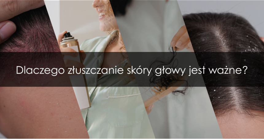 Peeling skóry głowy – dlaczego warto go stosować? Działanie, efekty i zastosowanie