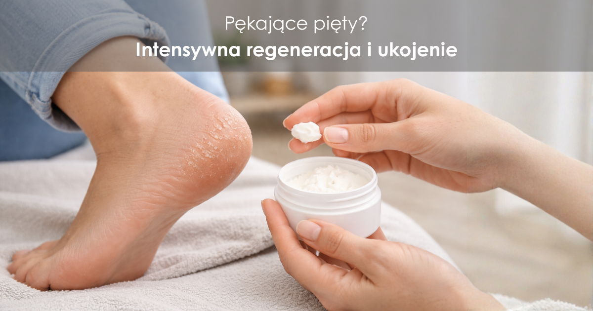 Pękające pięty – co pomaga? Maść konopna, mocznik czy witamina A