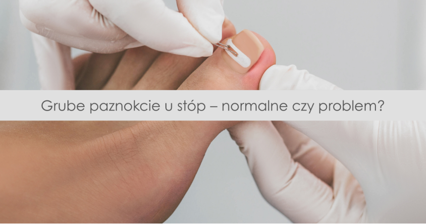 Dlaczego paznokcie u stóp są grubsze niż u rąk